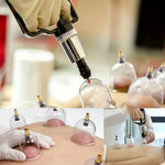 18pcs Set Cupping Relaxation Kit with Hand Pump and Detailed Cupping Manual for Multiple Sizes of Vacuum Cups Massage Cupping view 2